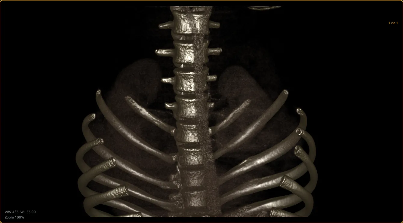 Akhet PACS with 3D